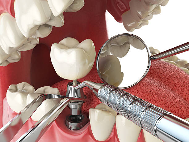Best Broken or Cracked Tooth Emergency Dentist in North Shore, VA