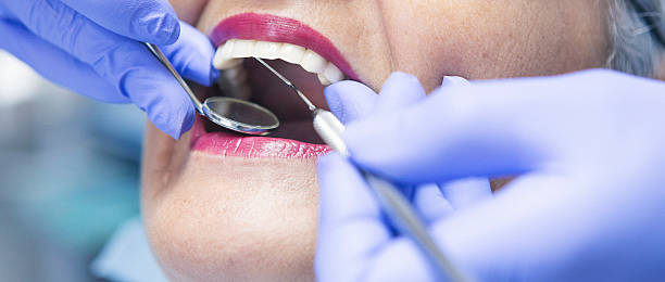 Best Holiday Emergency Dentist in North Shore, VA